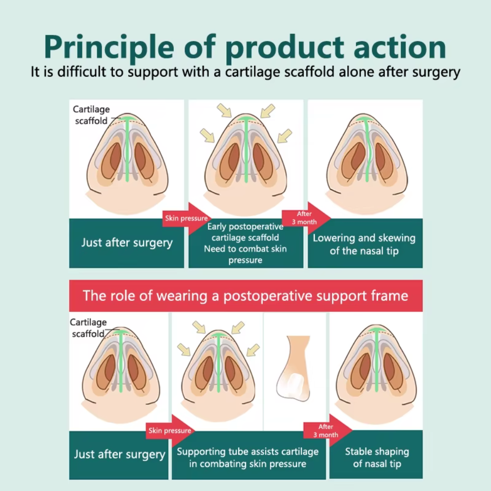 POSTOPERATIVE RHINOPLASTY NOSTRIL SUPPORT SILICONE DIAMETER 9mm-1